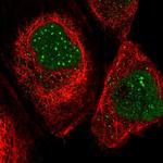 SP100 Antibody in Immunocytochemistry (ICC/IF)