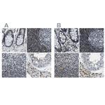 SP100 Antibody in Immunohistochemistry (IHC)