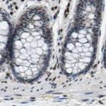 SP100 Antibody in Immunohistochemistry (IHC)