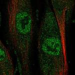 NAALADL2 Antibody in Immunocytochemistry (ICC/IF)