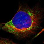 FIS1 Antibody in Immunocytochemistry (ICC/IF)