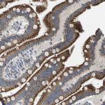 FIS1 Antibody in Immunohistochemistry (IHC)