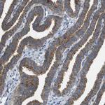 FIS1 Antibody in Immunohistochemistry (IHC)