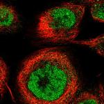 CTPS2 Antibody in Immunocytochemistry (ICC/IF)