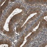 CTPS2 Antibody in Immunohistochemistry (Paraffin) (IHC (P))