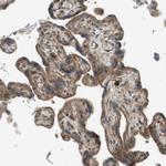 CTPS2 Antibody in Immunohistochemistry (Paraffin) (IHC (P))