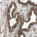 CTPS2 Antibody in Immunohistochemistry (Paraffin) (IHC (P))