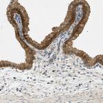 NUDT4 Antibody in Immunohistochemistry (IHC)