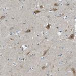 SNX14 Antibody in Immunohistochemistry (Paraffin) (IHC (P))