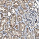 SNX14 Antibody in Immunohistochemistry (Paraffin) (IHC (P))