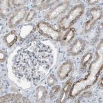 MRS2 Antibody in Immunohistochemistry (Paraffin) (IHC (P))