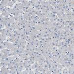 MRS2 Antibody in Immunohistochemistry (Paraffin) (IHC (P))