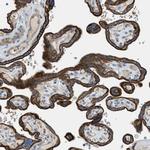 MRS2 Antibody in Immunohistochemistry (Paraffin) (IHC (P))