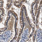 HS3ST2 Antibody in Immunohistochemistry (Paraffin) (IHC (P))