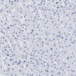 PRSS16 Antibody in Immunohistochemistry (IHC)