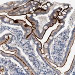 ADCY10 Antibody in Immunohistochemistry (Paraffin) (IHC (P))