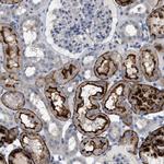 ADCY10 Antibody in Immunohistochemistry (Paraffin) (IHC (P))