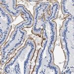 DLC1 Antibody in Immunohistochemistry (Paraffin) (IHC (P))