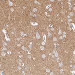 ATCAY Antibody in Immunohistochemistry (IHC)