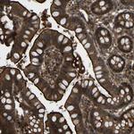 CYP7B1 Antibody in Immunohistochemistry (Paraffin) (IHC (P))