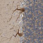 BEND3 Antibody in Immunohistochemistry (Paraffin) (IHC (P))