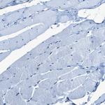 OGFR Antibody in Immunohistochemistry (Paraffin) (IHC (P))