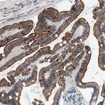 Nudel Antibody in Immunohistochemistry (Paraffin) (IHC (P))