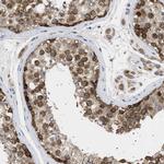 NUP93 Antibody in Immunohistochemistry (IHC)