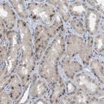 NUP93 Antibody in Immunohistochemistry (IHC)