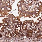 LSM14A Antibody in Immunohistochemistry (Paraffin) (IHC (P))