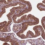 LSM14A Antibody in Immunohistochemistry (Paraffin) (IHC (P))