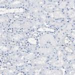 SPAM1 Antibody in Immunohistochemistry (Paraffin) (IHC (P))