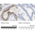 SPAM1 Antibody in Immunohistochemistry (IHC)