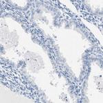 SPAM1 Antibody in Immunohistochemistry (IHC)