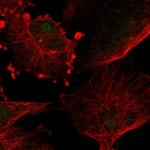 TUB Antibody in Immunocytochemistry (ICC/IF)