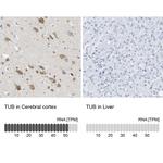 TUB Antibody in Immunohistochemistry (Paraffin) (IHC (P))