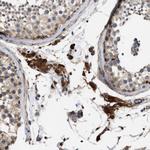 SLC4A11 Antibody in Immunohistochemistry (Paraffin) (IHC (P))