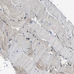 SMPD2 Antibody in Immunohistochemistry (Paraffin) (IHC (P))