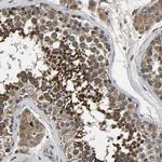 SMPD2 Antibody in Immunohistochemistry (IHC)