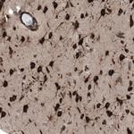 GPIP137 Antibody in Immunohistochemistry (IHC)