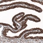 GPIP137 Antibody in Immunohistochemistry (IHC)