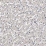 NAV1 Antibody in Immunohistochemistry (Paraffin) (IHC (P))