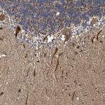 NAV1 Antibody in Immunohistochemistry (IHC)