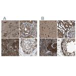 ARFGAP2 Antibody in Immunohistochemistry (IHC)