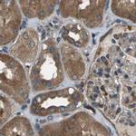 ARFGAP2 Antibody in Immunohistochemistry (IHC)