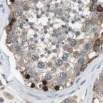 ARFGAP2 Antibody in Immunohistochemistry (IHC)