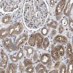 YBEY Antibody in Immunohistochemistry (Paraffin) (IHC (P))