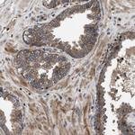 YBEY Antibody in Immunohistochemistry (Paraffin) (IHC (P))