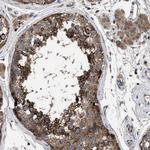 YBEY Antibody in Immunohistochemistry (Paraffin) (IHC (P))