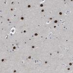 ENT2 Antibody in Immunohistochemistry (Paraffin) (IHC (P))